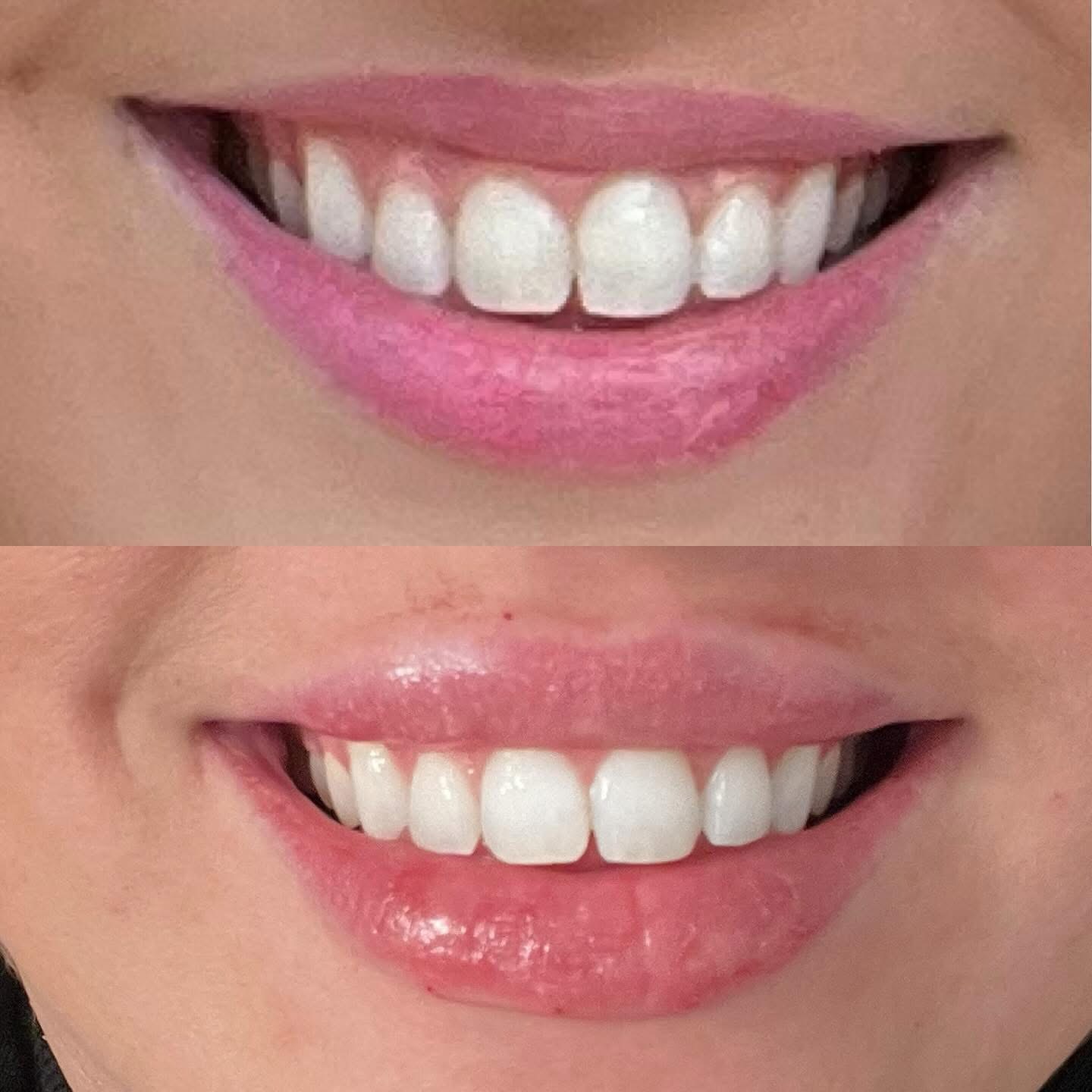 Eternal Youth Cosmetic Injections