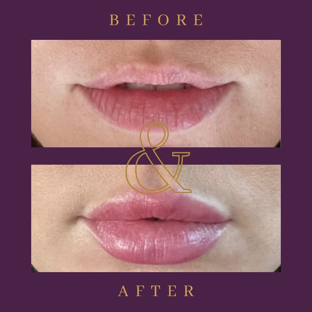 Eternal Youth Cosmetic Injections