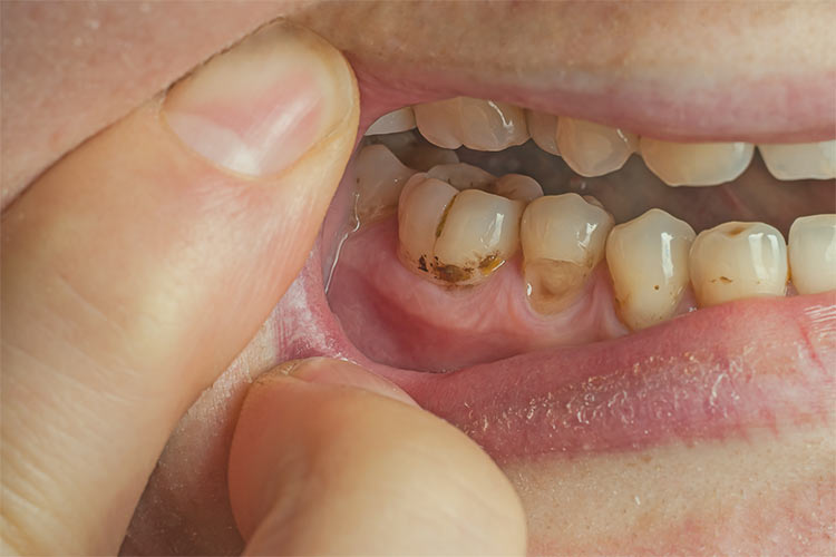 O2 Dental – Vancouver