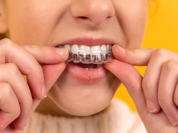 Mercato Dental Centre