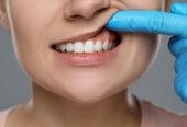 Ace Dental Centers – Dentist in Vancouver & Coquitlam